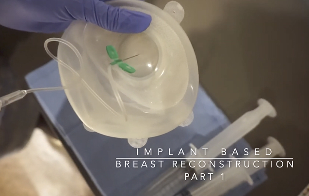 What Does the Breast Reconstruction Procedure Involve?