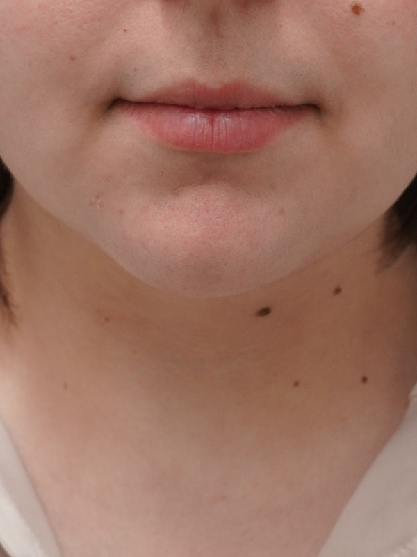 After